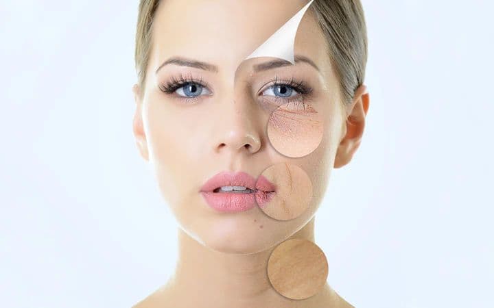 Skin Rejuvenation