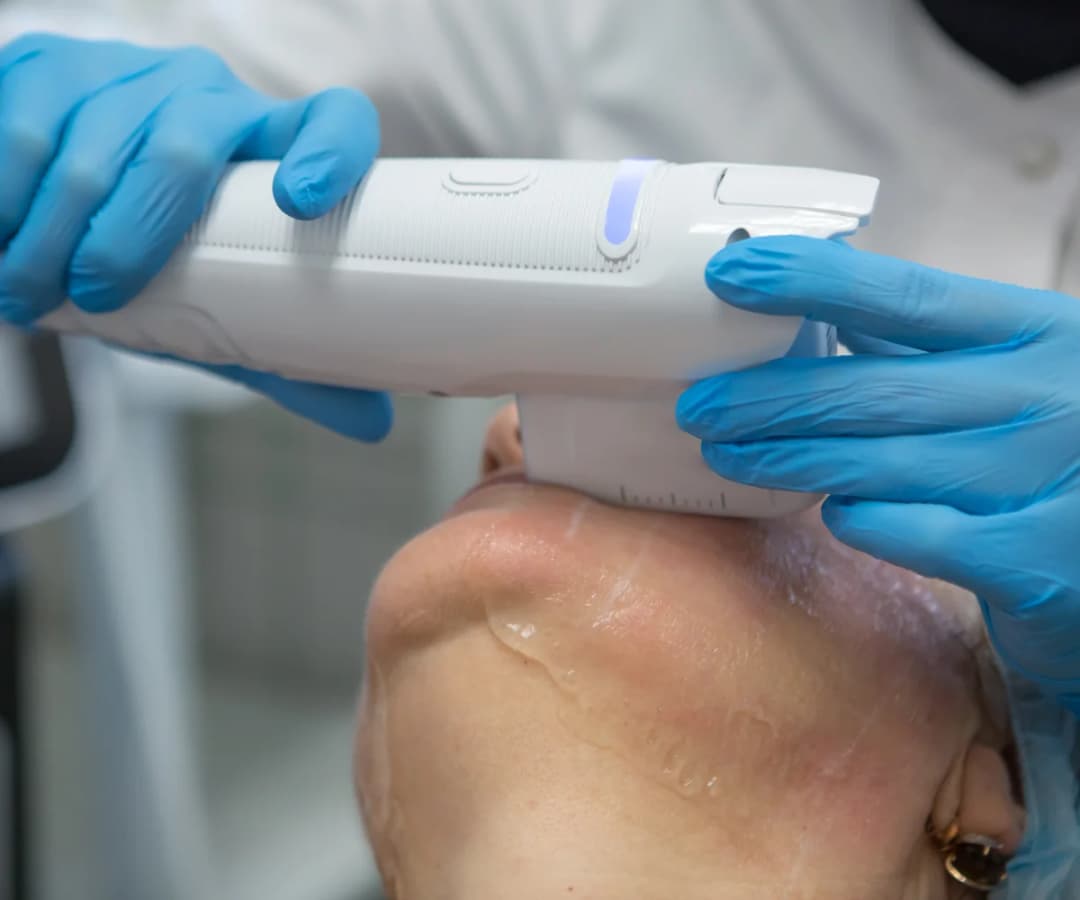 Laser Hair Reduction